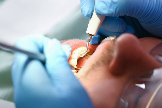 Best Emergency Care for Gum Disease in High Point, FL
